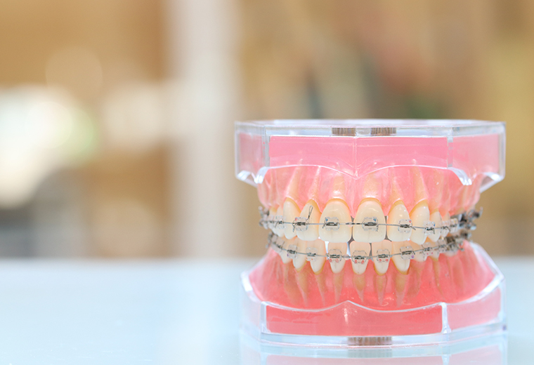 ハート歯科クリニックの治療メニュー