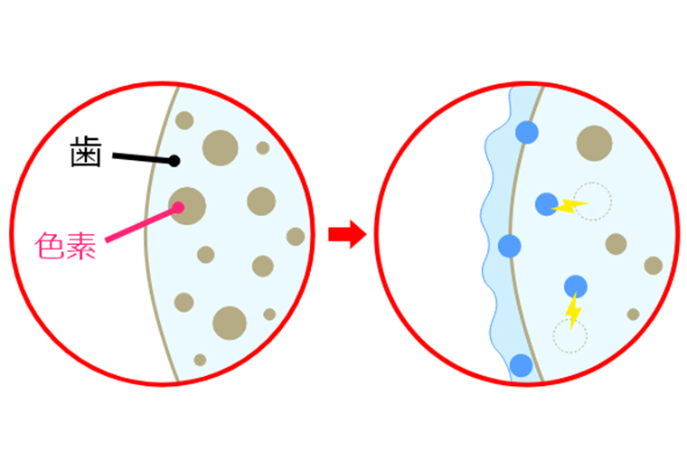 ホワイトニングで歯が白くなる仕組み